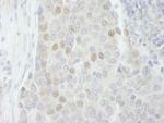 RBM27 Antibody in Immunohistochemistry (Paraffin) (IHC (P))
