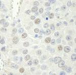 Rtf1 Polyclonal Antibody