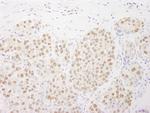 Rtf1 Antibody in Immunohistochemistry (Paraffin) (IHC (P))
