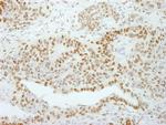 GTF2I/TFII-I Antibody in Immunohistochemistry (Paraffin) (IHC (P))