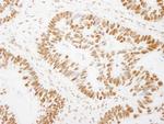 GTF2I/TFII-I Antibody in Immunohistochemistry (Paraffin) (IHC (P))