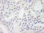 GTF2IRD/TFII-IRD1 Antibody in Immunohistochemistry (Paraffin) (IHC (P))
