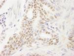 DEK Antibody in Immunohistochemistry (Paraffin) (IHC (P))