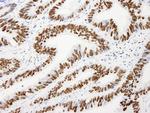 AKAP8L/HA95 Antibody in Immunohistochemistry (Paraffin) (IHC (P))