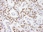 AKAP8L/HA95 Polyclonal Antibody