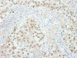 BRCA1 Antibody in Immunohistochemistry (Paraffin) (IHC (P))