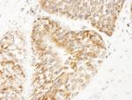 AKAP1 Antibody in Immunohistochemistry (Paraffin) (IHC (P))