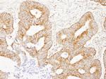 AKAP1 Antibody in Immunohistochemistry (Paraffin) (IHC (P))