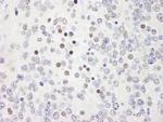 WRNIP1 Antibody in Immunohistochemistry (Paraffin) (IHC (P))