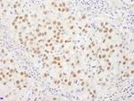 WRNIP1 Antibody in Immunohistochemistry (Paraffin) (IHC (P))