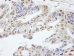 UACA Polyclonal Antibody