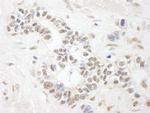 ANKS3 Polyclonal Antibody