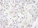 ANKS3 Antibody in Immunohistochemistry (Paraffin) (IHC (P))