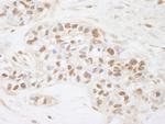 CDC25c Polyclonal Antibody