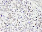 CDC25c Antibody in Immunohistochemistry (Paraffin) (IHC (P))