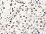 CDC25c Antibody in Immunohistochemistry (Paraffin) (IHC (P))