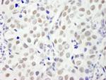 DFF45/DFFA Antibody in Immunohistochemistry (Paraffin) (IHC (P))