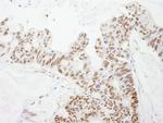 DFF45/DFFA Antibody in Immunohistochemistry (Paraffin) (IHC (P))