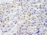 PHF6 Antibody in Immunohistochemistry (Paraffin) (IHC (P))