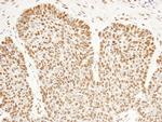 FIP1 Antibody in Immunohistochemistry (Paraffin) (IHC (P))