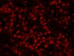 FIP1 Antibody in Immunohistochemistry (Paraffin) (IHC (P))
