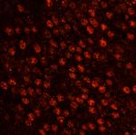 SART3/TIP110 Polyclonal Antibody