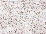 SART3/TIP110 Antibody in Immunohistochemistry (Paraffin) (IHC (P))