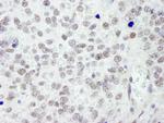 RanBP3 Antibody in Immunohistochemistry (Paraffin) (IHC (P))