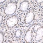 ZFP106 Polyclonal Antibody