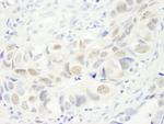 Anillin Polyclonal Antibody