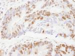 ZNF295 Antibody in Immunohistochemistry (Paraffin) (IHC (P))