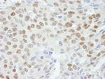 ZNF295 Polyclonal Antibody