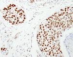NUMA Antibody in Immunohistochemistry (Paraffin) (IHC (P))