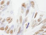 NUMA Antibody in Immunohistochemistry (Paraffin) (IHC (P))
