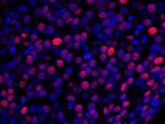 NUCKS Antibody in Immunohistochemistry (Paraffin) (IHC (P))