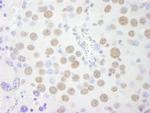 PSF/SFPQ Antibody in Immunohistochemistry (Paraffin) (IHC (P))