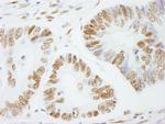 PSF/SFPQ Antibody in Immunohistochemistry (Paraffin) (IHC (P))