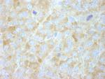 FASN Polyclonal Antibody