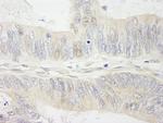 MYBBP1A Antibody in Immunohistochemistry (Paraffin) (IHC (P))