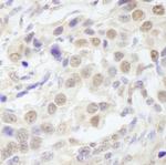TAF6 Antibody in Immunohistochemistry (Paraffin) (IHC (P))