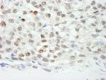 ZNF318/TZF Antibody in Immunohistochemistry (Paraffin) (IHC (P))