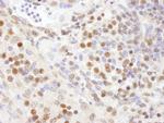 SF3a120/SAP114 Antibody in Immunohistochemistry (Paraffin) (IHC (P))