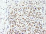 SF3b145/SAP145 Antibody in Immunohistochemistry (Paraffin) (IHC (P))