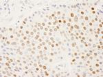 SFRS14 Polyclonal Antibody