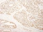 SFRS14 Antibody in Immunohistochemistry (Paraffin) (IHC (P))