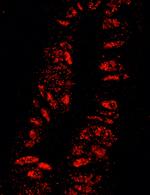 KPNA3 Polyclonal Antibody