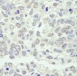 KPNA3 Antibody in Immunohistochemistry (Paraffin) (IHC (P))