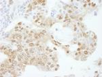 KPNA3 Antibody in Immunohistochemistry (Paraffin) (IHC (P))