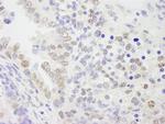 KPNA4 Antibody in Immunohistochemistry (Paraffin) (IHC (P))