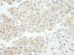 TDP1 Polyclonal Antibody